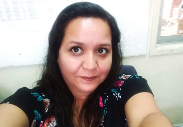 Janina Carvajal: “con la depilación láser le dije adiós al hirsutismo”