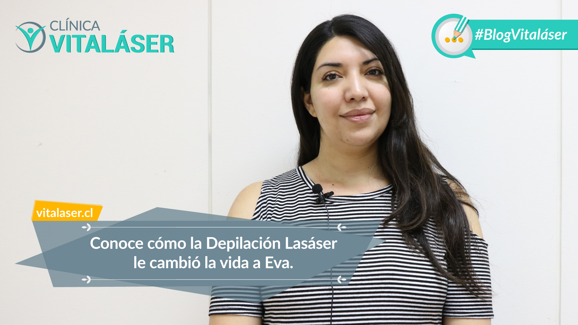 Testimonio Depilación Láser: “Vitaláser marca la diferencia en lo referente a Depilación Láser en Santiago”
