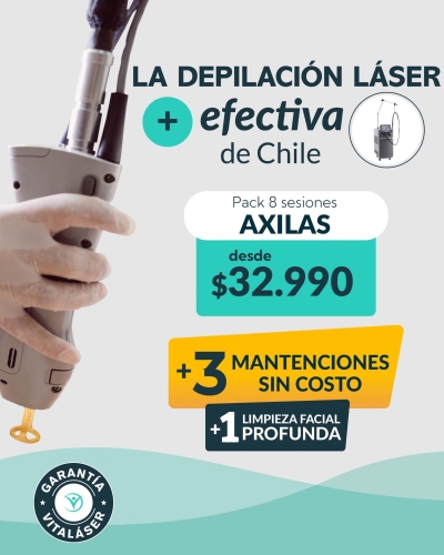 La Depilación Láser + Efectiva de Chile